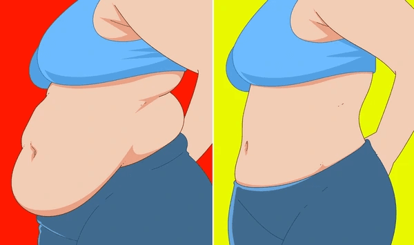 Weight loss support